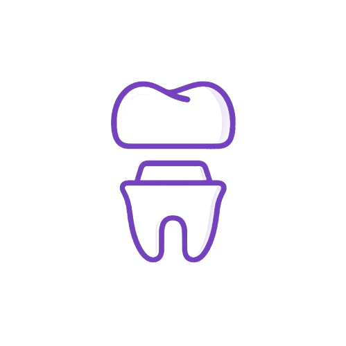 dental-Implants